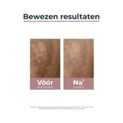 Eucerin Anti-Pigment Dagcrème SPF30 50 ML