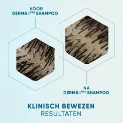 Head & Shoulders Derma X Pro Kalmeert Anti-Roos Shampoo 250 ML