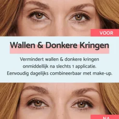 Remescar Wallen & Donkere Kringen Crème 8 ML