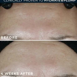 RoC Multi-Correxion Hydrate & Plump Moisturiser SPF30 50 ML