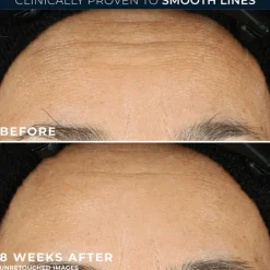 RoC Retinol Correxion Line Smoothing Night Serum 30 capsules