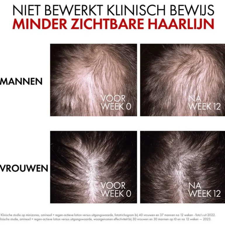 Vichy Dercos Aminexil Regenerating Serum 90 ML