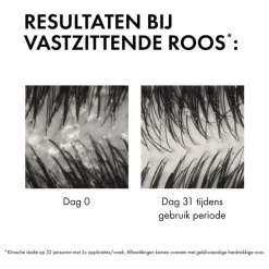 Vichy Dercos Anti-Roos DS Shampoo NH/VH Navulling 390 ML